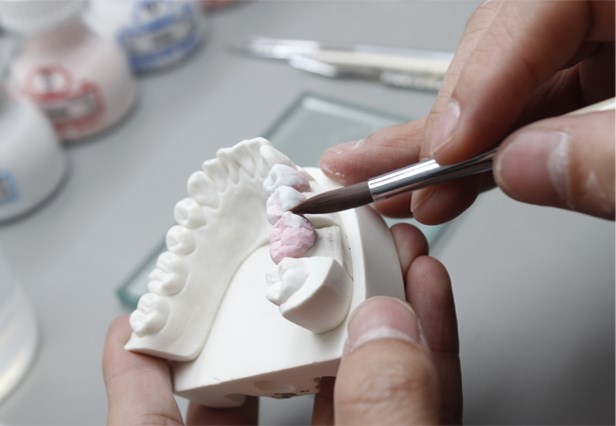 Dental Base Metal Alloy